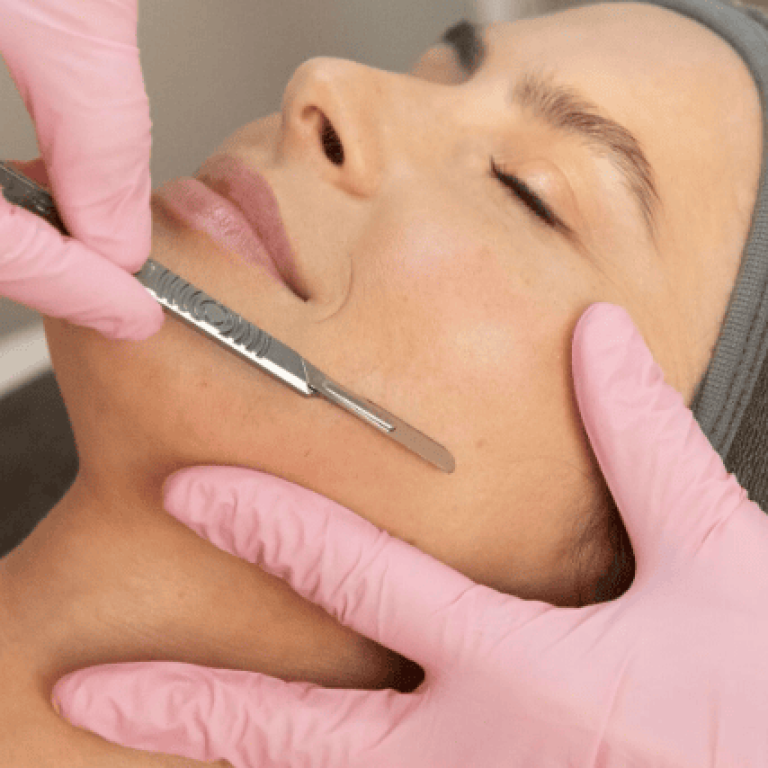 dermaplaning